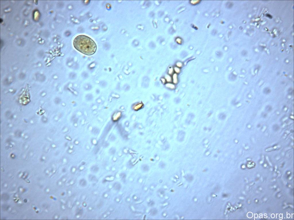 paraziták golyója körömféreg petesejtek meg nem termékenyített kezelése